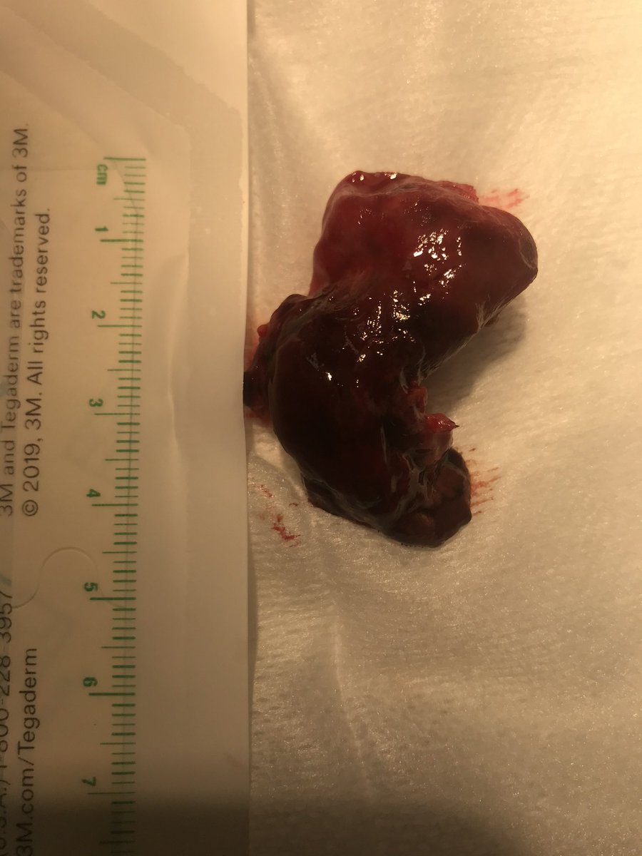 Udit Chaddha tweet media