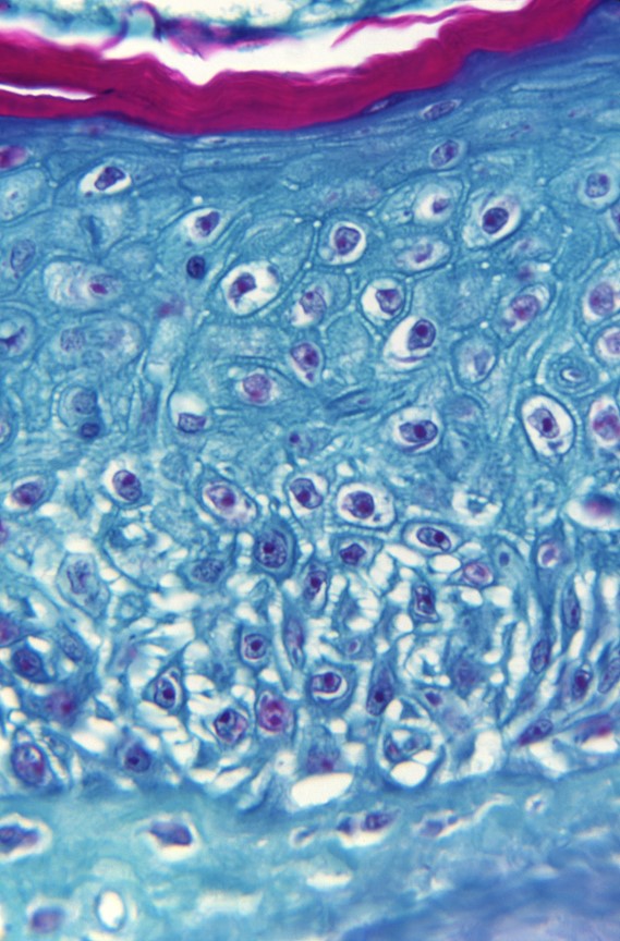 Monkeypox Update: As of June 7, 1,088 confirmed or probable #monkeypox cases have been identified in 29 countries, including 35 cases in the US. Learn more: bit.ly/3t3dCiy.