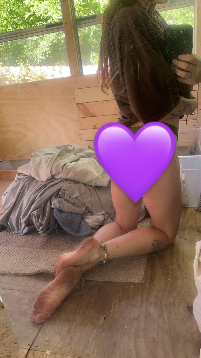 katari_wolf's tweet image. subscribe to my #onlyfans to see how bad I burnt my ass 😅🥲 onlyfans.com/trippy_lil_hip…