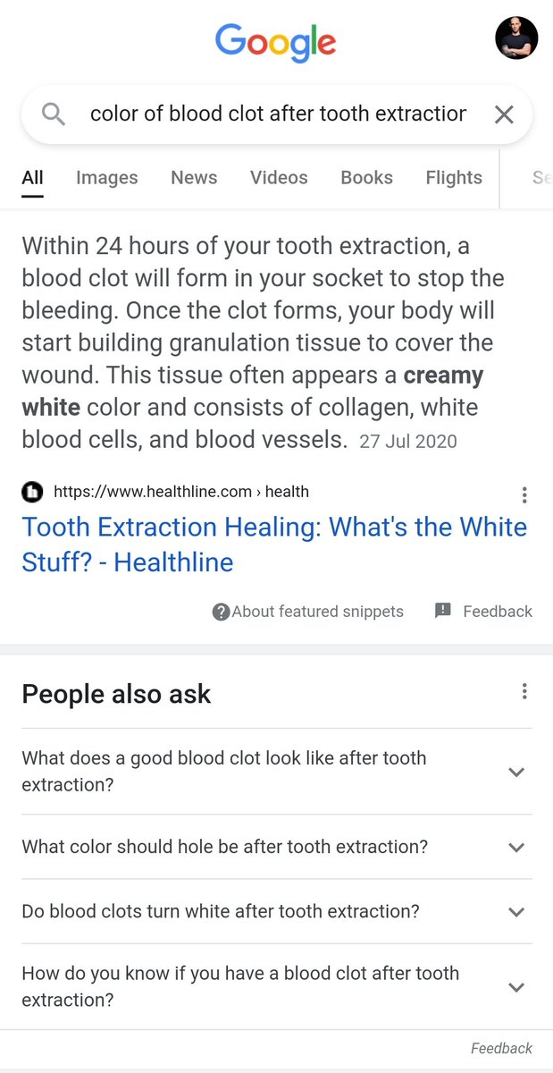 Ori Silver tweet media