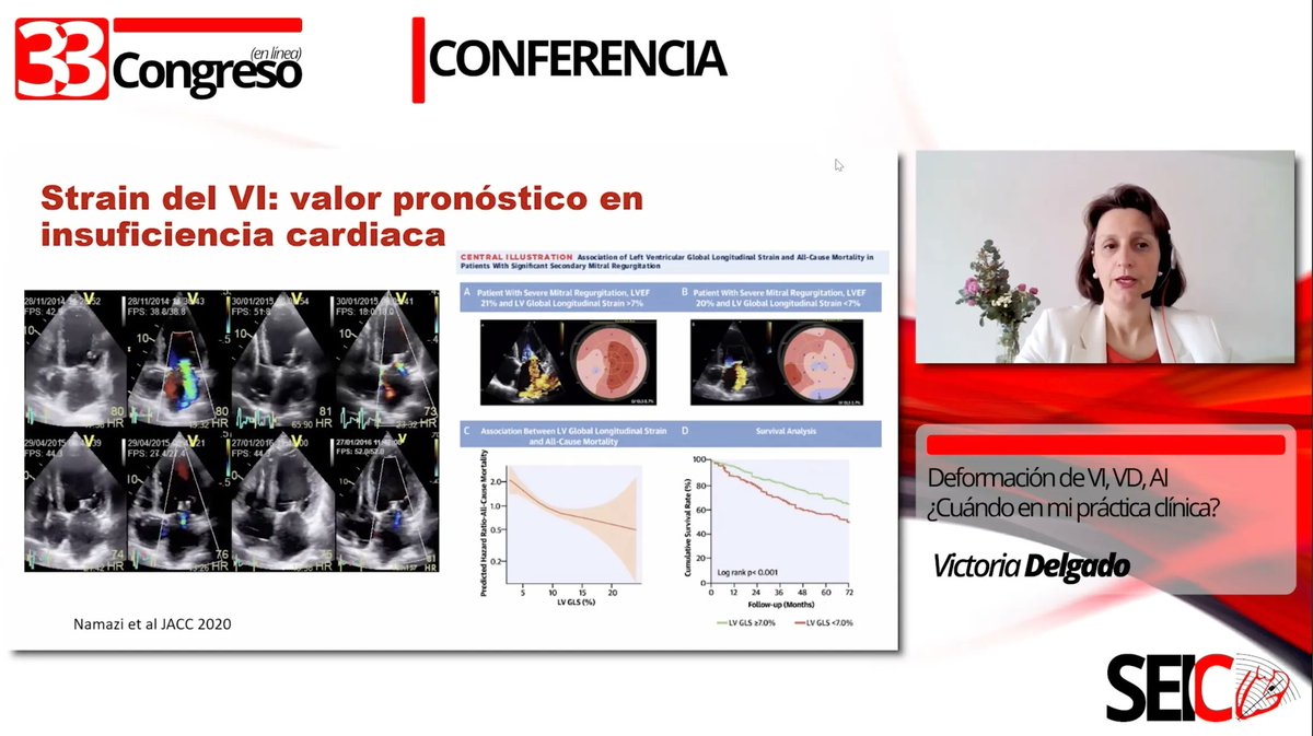 ImagenCardiaca's tweet photo. Deformación de VI, VD, AI ¿Cuándo en mi práctica clínica? - Victoria Delgado
🔔 https://t.co/Xcyf2JYJGP
Conferencia de la #33SEIC https://t.co/pxIOSZy2Vr