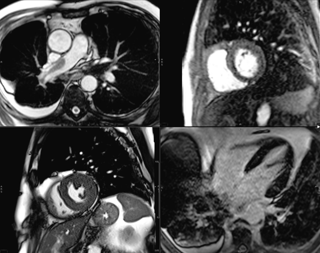 Respect the scout images, they may  have the non-cardiac answer. #WhyCMR