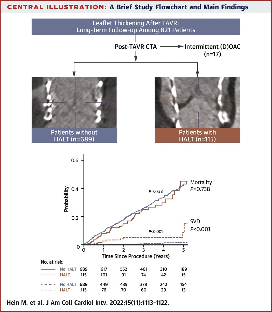 JACCJournals's tweet photo. What are the long-term outcomes of HALT in #TAVR? At 3 years, there's no increase mortality or death, but has association with symptomatic hemodynamic valve deterioration. https://t.co/OW1p7CuKFh

#JACCINT #CardioTwitter @ManuImaging @kardiophil https://t.co/H03rX5fpjQ