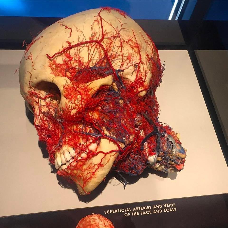 Este modelo anatómico ejemplifica las arterias y venas superficiales de la cara y cuero cabelludo.