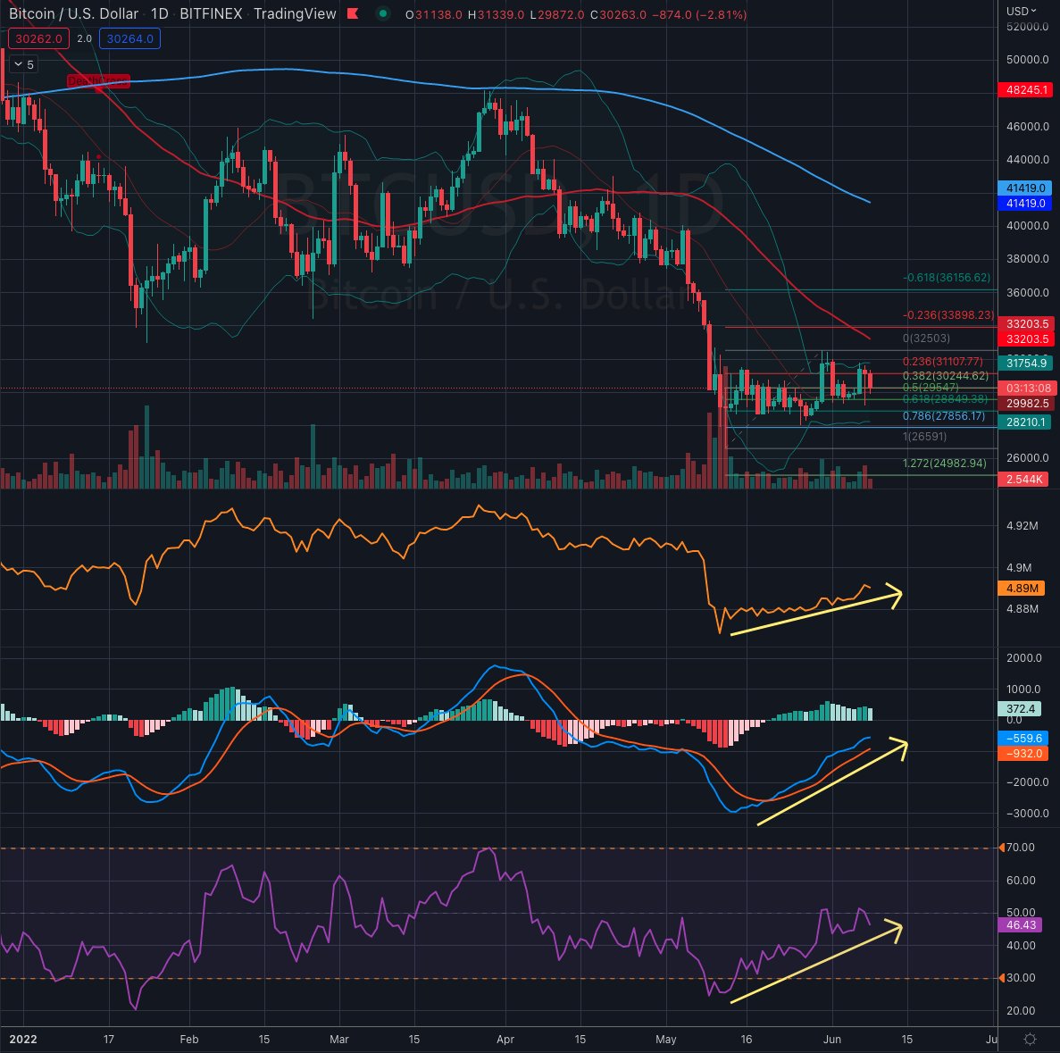 CryptoChartStrm's tweet image. #BTC #Bitcoin [Daily Chart] Continues to base within tight Bollinger Bands. Key levels are 31.7k/28.2k. First breakout attempt failed, however it continues to tap the upper Bollinger band while accumulation is picking up and MACD/RSI are trending up. 👀