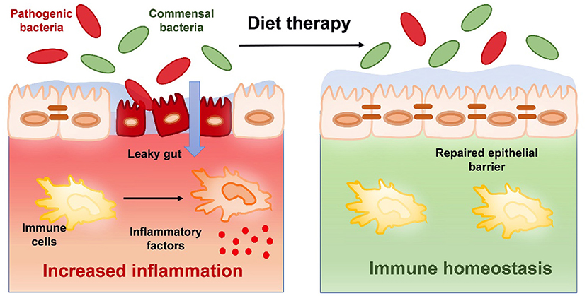 HeLaboratory's tweet photo. Nutraceuticals for Treatment of #IBD: Current Progress &amp; Future Directions
https://t.co/7xSneTkhE0 https://t.co/hOGeQWsZo0