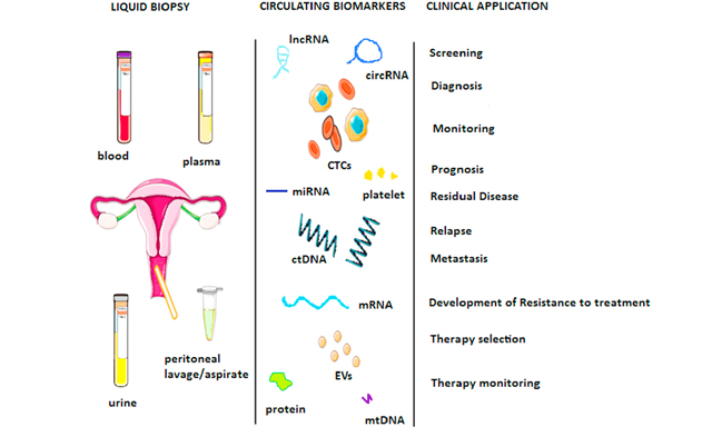 OAE_JCMT's tweet image. 🙌🙌Interesting article sharing #Endometrialcancer #liquidbiopsy #longnoncodingRNA #circularRNA #circulatingtumorDNA 

This is a high-quality Review of the &quot;Liquid biopsy in endometrial cancer&quot;.

Let&apos;s read it.
jcmtjournal.com/article/view/3…
