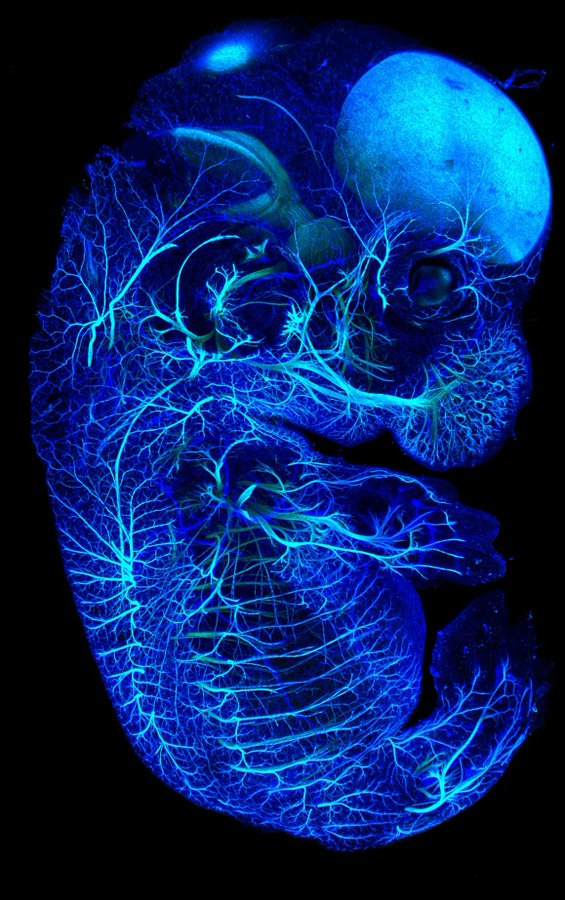 This is what nervous system of a mouse embryo looks like:

#biology by N. Burns