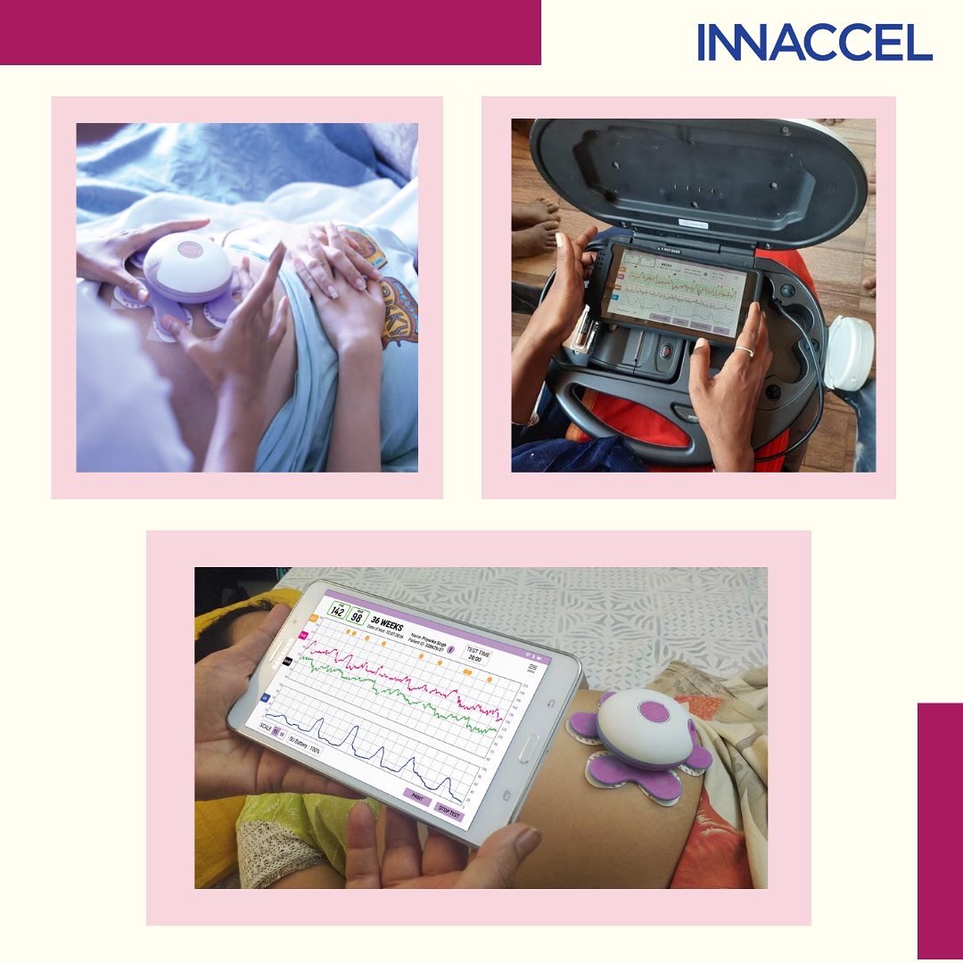 Fetal Lite Fetal Monitoring System A superior labour monitoring experience for you and your patients. *healthcare #health #innaccel #criticalhealth #maternalhealth #childcare #medicaldevice #fetallite #maternity #child