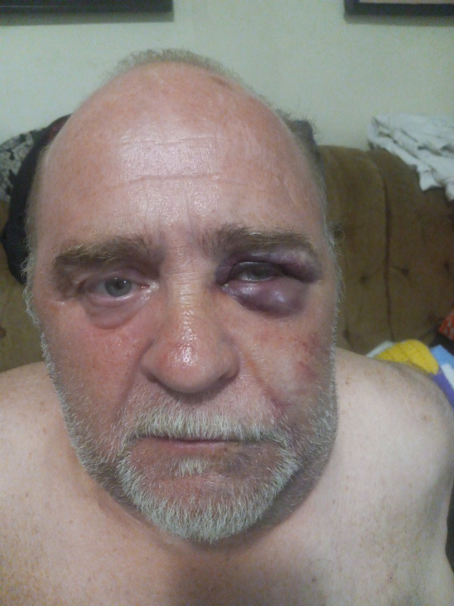 nicholasxdrew's tweet photo. @pulte my pops got robbed yesterday on his way home from the food bank they took his phone &amp; wallet the only stuff he even has left to his name after struggling these last few months after a 26 year career with the NJDOT he definitely didn't deserve it anything helps $NicholasxDrew https://t.co/rTAvoka8dx