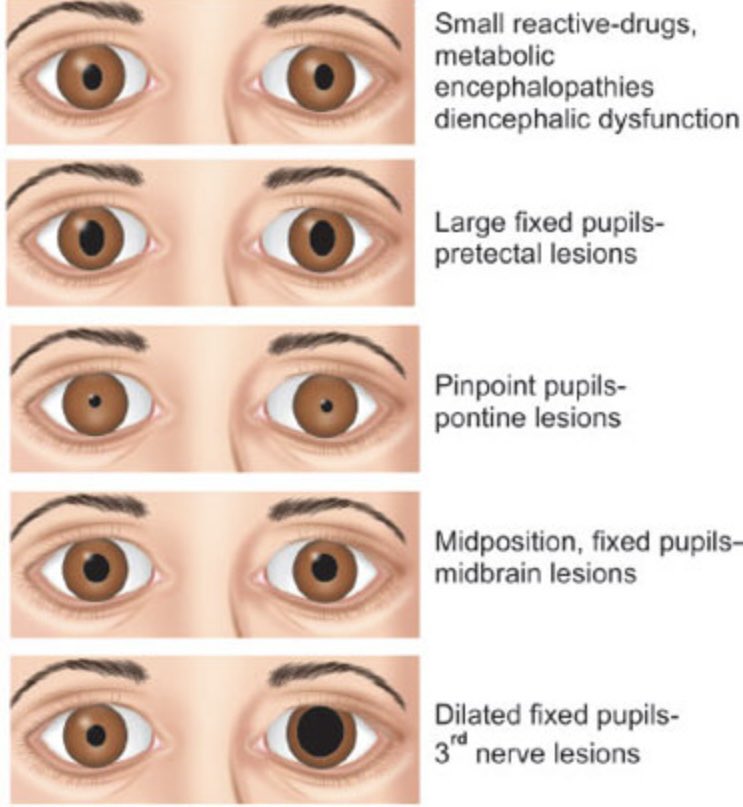 The eyes don’t lie: check them out to know what’s going on with the #brain.