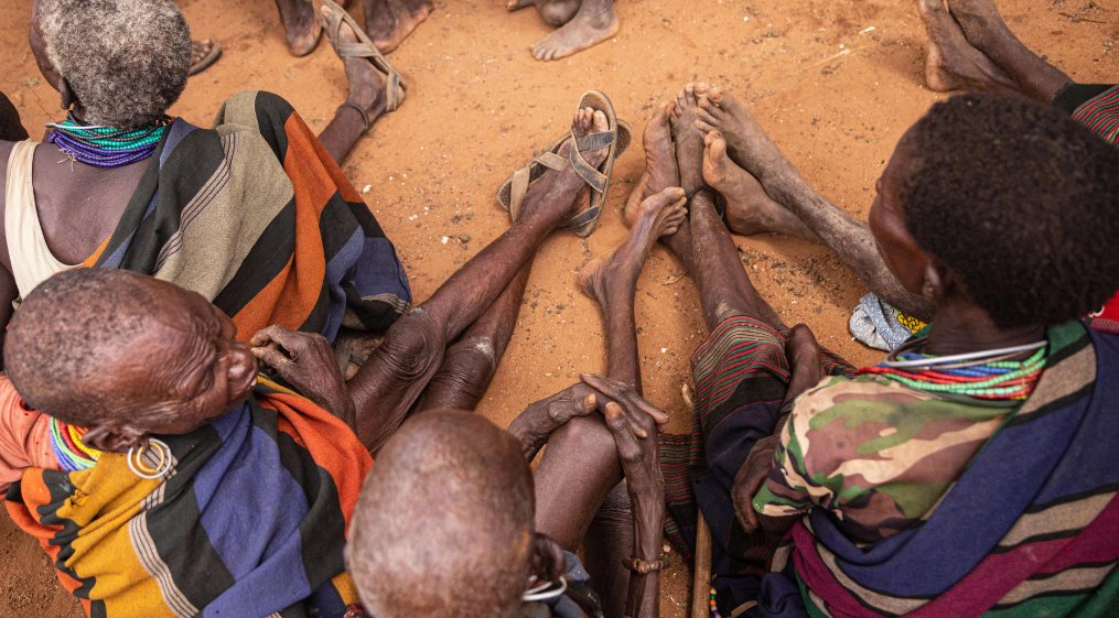 AJEnglish's tweet photo. "The child was not sick. It was purely hunger that killed him.”

More than 91,000 children are suffering from acute malnutrition in one of Uganda’s poorest regions — in pictures https://t.co/kTGhIjdsm4 https://t.co/AbFsNFbis0