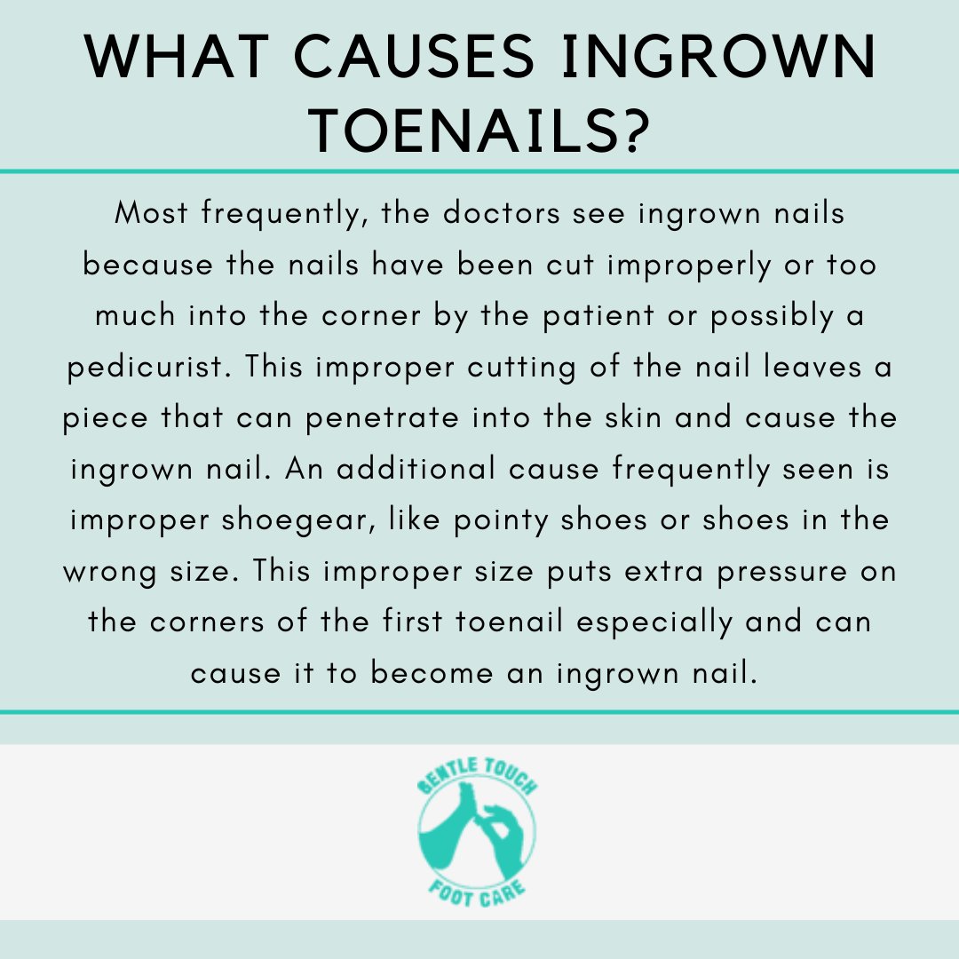 For more information on causes and treatment of ingrown toenails, contact us today! Link in bio.
.
.
.
#GTFC #gentletouchfootcare #ingrowntoenail #ingrowntoenails #toenails #health #nails #podiatrist #surgeon #toenailhealth #doctor #bestdoctors  #footandankle #toes  #paronychia