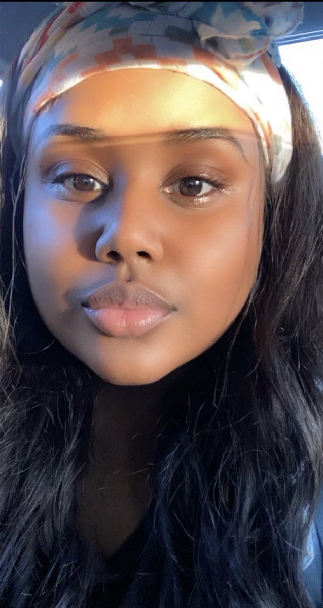 Sun kiss 💋