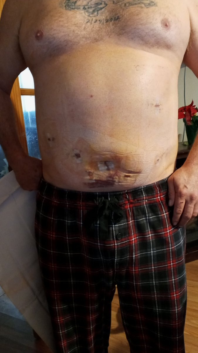 JonMccord7's tweet photo. @Jayecane I already told you on another post. Please do.
I got home from the hospital today. Had major surgery. And raising my 13 year old granddaughter. https://t.co/c98pgFp1vB