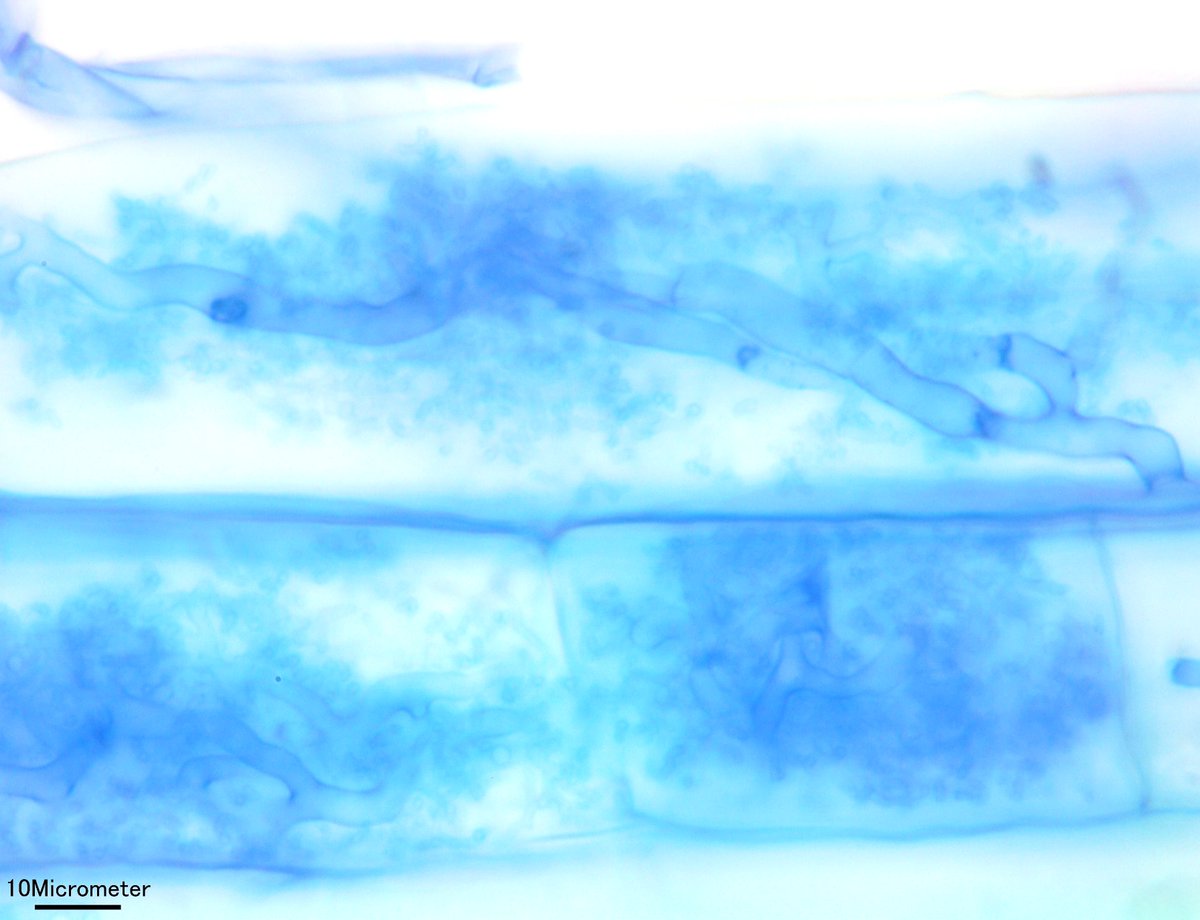 takeshi_sentoku's tweet photo. ダイズ(Glycine max)の実生の根の樹枝状体(arbuscule)
#菌根菌 #mycorrhizae #arbuscule https://t.co/ixIalvBclc