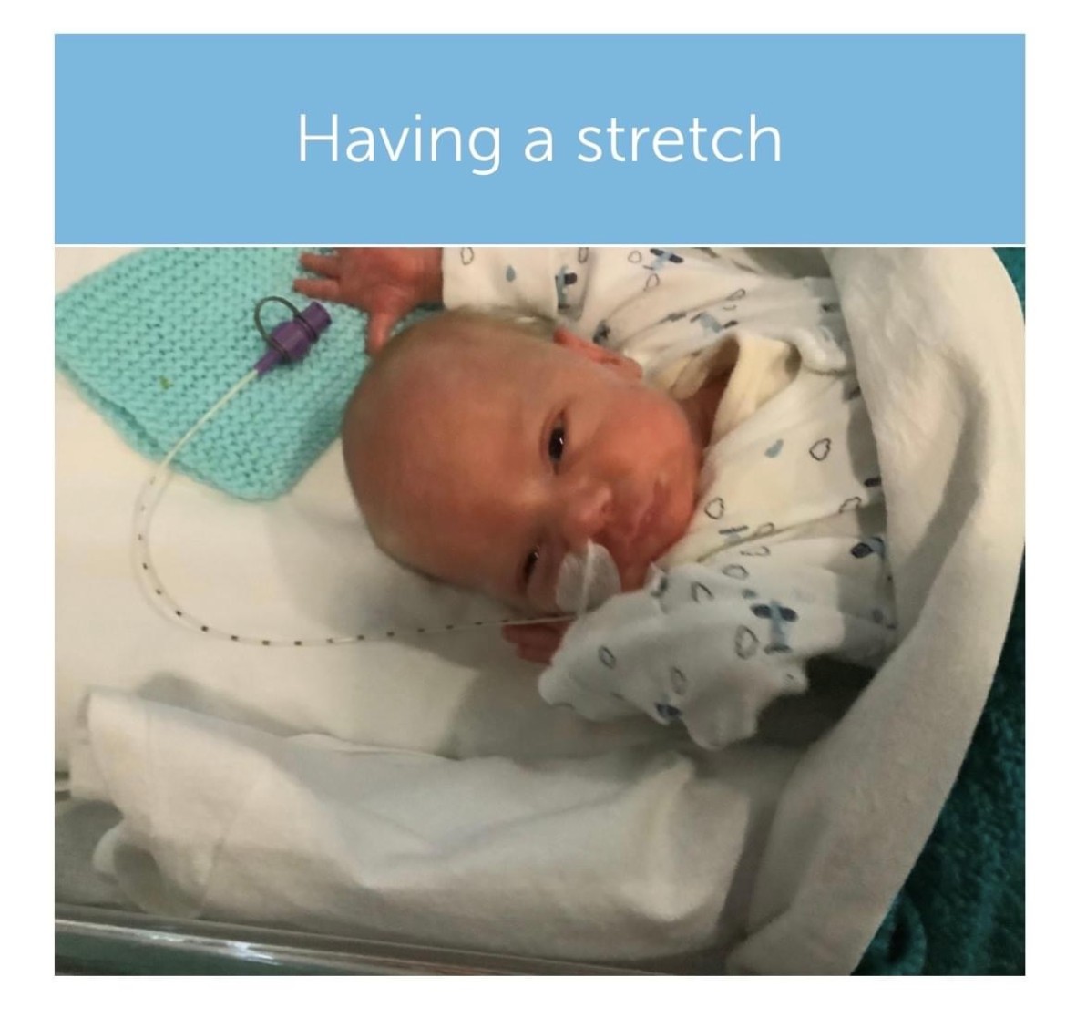 vCreateNICU's tweet photo. Kia has shared her favourite #vCreateMoments of son, Kaèiyton’chae. These were sent to Kia when she couldn't be on the unit with her sweet boy. 💕
#photoupdates #videoupdates #keepingfamiliesconnected https://t.co/KmMmoeKH0p