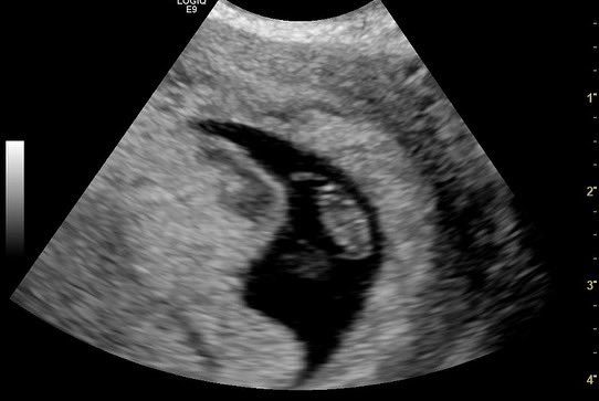 Patrycia💡 tweet media