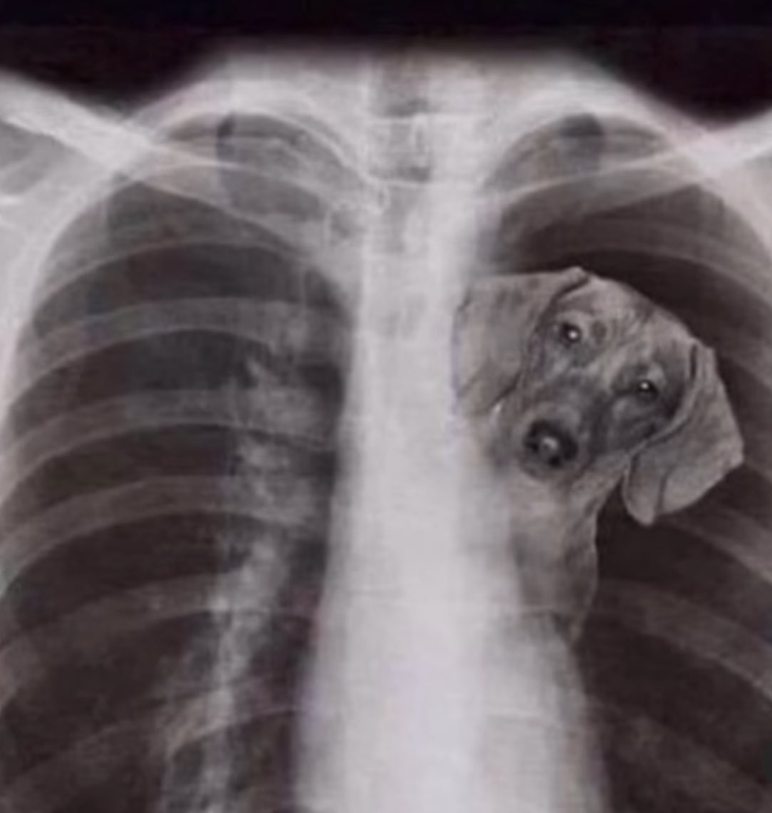 Gerrit Cole's x-ray https://t.co/69vaELvY38