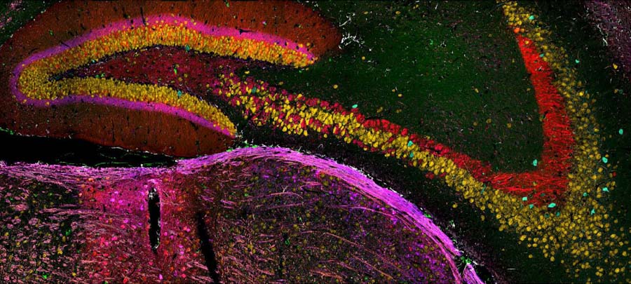 PICASSO Technique Drives #BiologicalMolecules into Technicolor:The new imaging approach brings current imaging colors from four to more than 15 for mapping overlapping #proteins 🥰🤖
🔗news.kaist.ac.kr/newsen/html/ne…