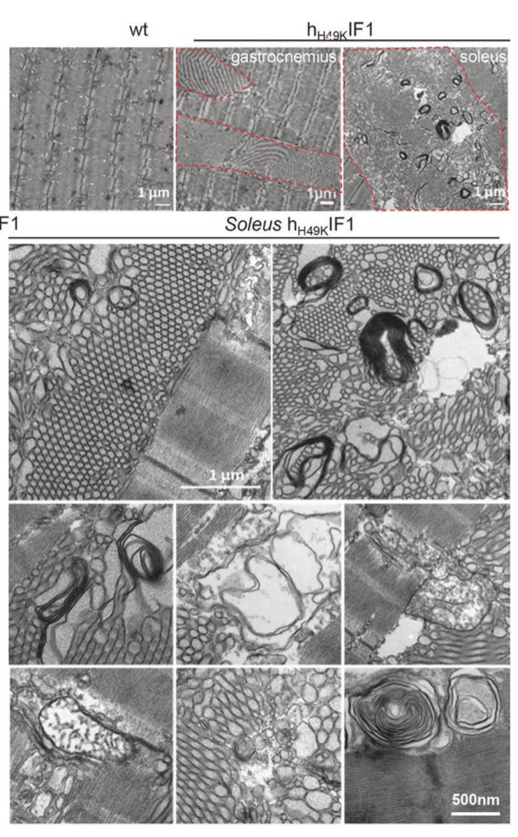 Inhibiting the mitochondrial ATP synthase induces skeletal muscle tubular aggregates 
nature.com/articles/s4141…