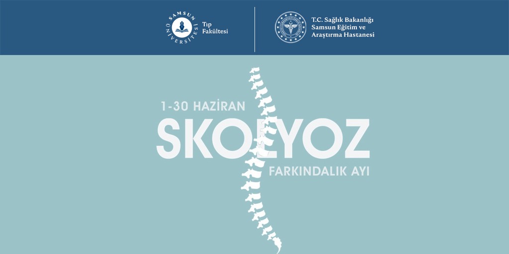 Skolyozdan değil, geç kalmaktan kork
1-30 Haziran Skolyoz Farkındalık Ayı
#samsunüniversitesi #tıpfakültesi #skolyozfarkındalıkayı