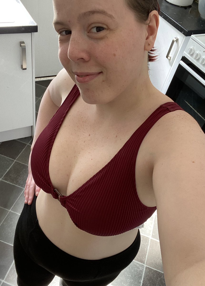 DanniRowson's tweet image. What Ostomy bag?! Loving the Summer weather right now 🥰🙌❤️ #ileostomy #chronicillness #ChronicPain #colorectalsurgery @ColostomyUK @Coloplast_UK @MeetAnOstoMate