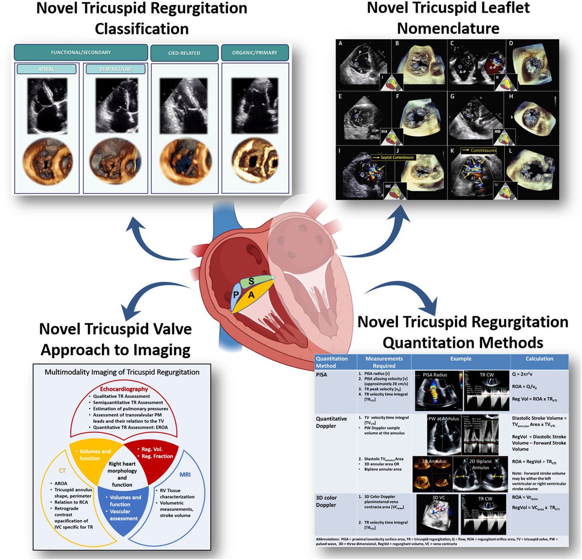 Henry Han (@hancardiomd) on Twitter photo Tricuspid regurgitation (#TR) : recent advances in understanding pathophysiology, severity grading and outcome
academic.oup.com/ehjcimaging/ar… #EHJCVI @GeraldMaurer <a href="/hahn_rt/">RTHahnMD</a> <a href="/denisamuraru/">Denisa Muraru</a> <a href="/EACVIPresident/">EACVI President</a> <a href="/DonalErwan/">Donal</a> <a href="/Cosyns/">Cosyns Bernard</a> <a href="/iamritu/">Ritu Thamman MD</a> <a href="/EchoSoliman/">Hatem Soliman, FRCP, FEACVI, FASE, FHEA</a> Tricuspid regurgitation (#TR) : recent advances in understanding pathophysiology, severity grading and outcome
academic.oup.com/ehjcimaging/ar… #EHJCVI @GeraldMaurer <a href="/hahn_rt/">RTHahnMD</a> <a href="/denisamuraru/">Denisa Muraru</a> <a href="/EACVIPresident/">EACVI President</a> <a href="/DonalErwan/">Donal</a> <a href="/Cosyns/">Cosyns Bernard</a> <a href="/iamritu/">Ritu Thamman MD</a> <a href="/EchoSoliman/">Hatem Soliman, FRCP, FEACVI, FASE, FHEA</a>