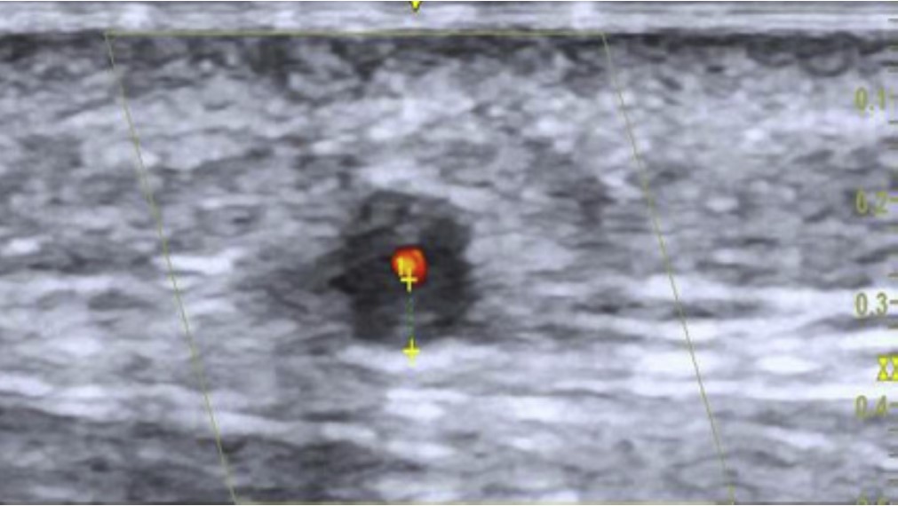 POCUS Toronto tweet media