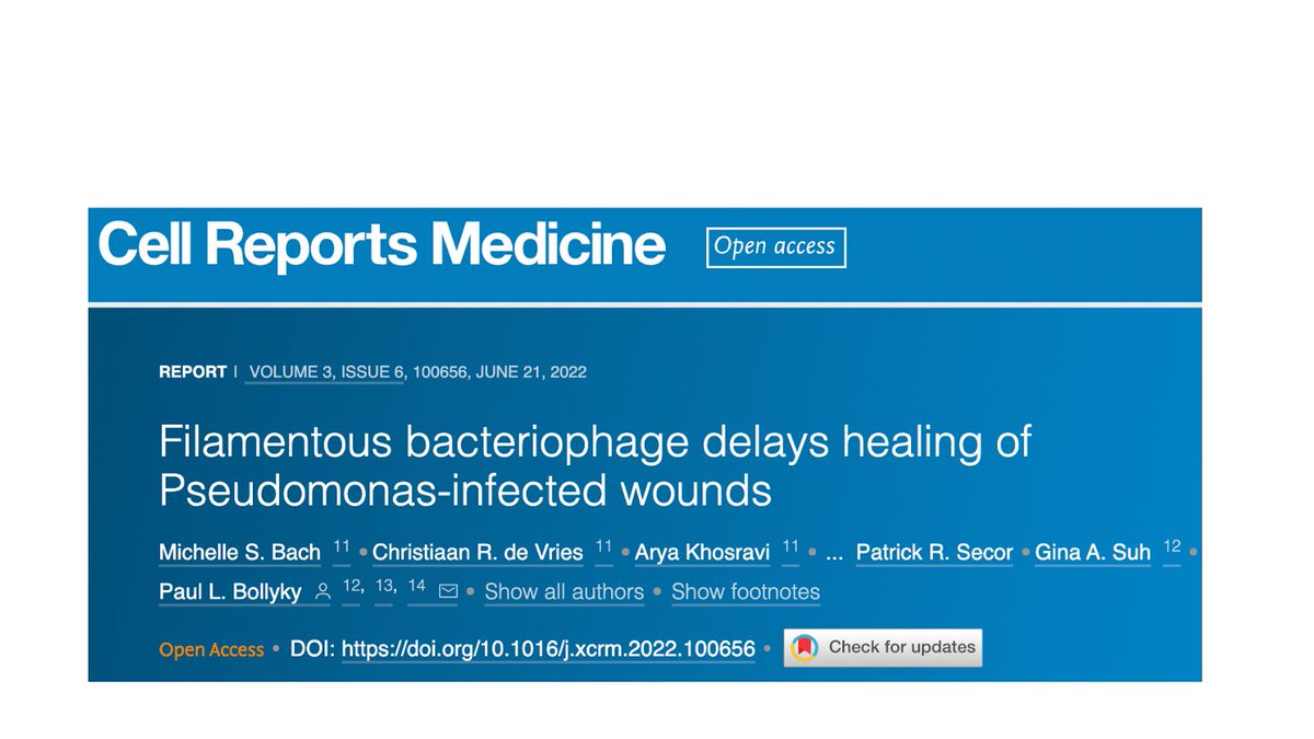 Paul Bollyky (@bollyky) on Twitter photo Hot off the presses - a temperate bacteriophage produced by Pseudomonas impairs wound healing by messing with keratinocyte migration. This was the result of a fantastic collaboration with @GinaSuhMD, <a href="/PRSecor/">Patrick R. Secor</a>, <a href="/ebburgenerMD/">Elizabeth B Burgener</a>, <a href="/SallyDemirdjian/">Sally Demirdjian</a> and more doi.org/10.1016/j.xcrm… Hot off the presses - a temperate bacteriophage produced by Pseudomonas impairs wound healing by messing with keratinocyte migration. This was the result of a fantastic collaboration with @GinaSuhMD, <a href="/PRSecor/">Patrick R. Secor</a>, <a href="/ebburgenerMD/">Elizabeth B Burgener</a>, <a href="/SallyDemirdjian/">Sally Demirdjian</a> and more doi.org/10.1016/j.xcrm…