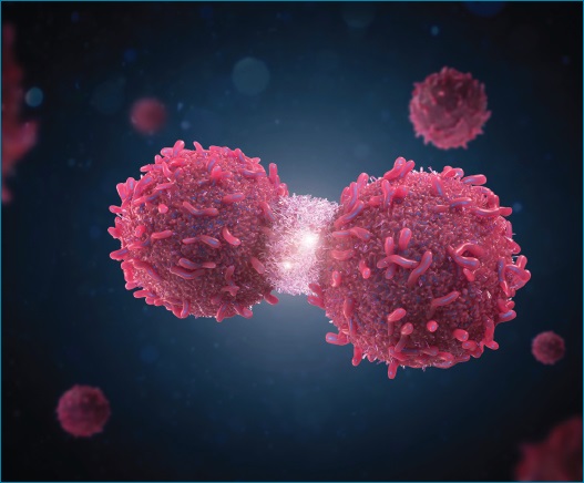 OncologyTimes's tweet photo. Oncologists at the @myESMO Breast Cancer 2022 conference discussed the life-extending benefits of treating metastases caused by #OMDs with multidisciplinary, metastasis-personalized treatment plans, especially in women with #bcmet. #bcsm: https://t.co/yMhvpEQOPK https://t.co/aQf3Cobc5R