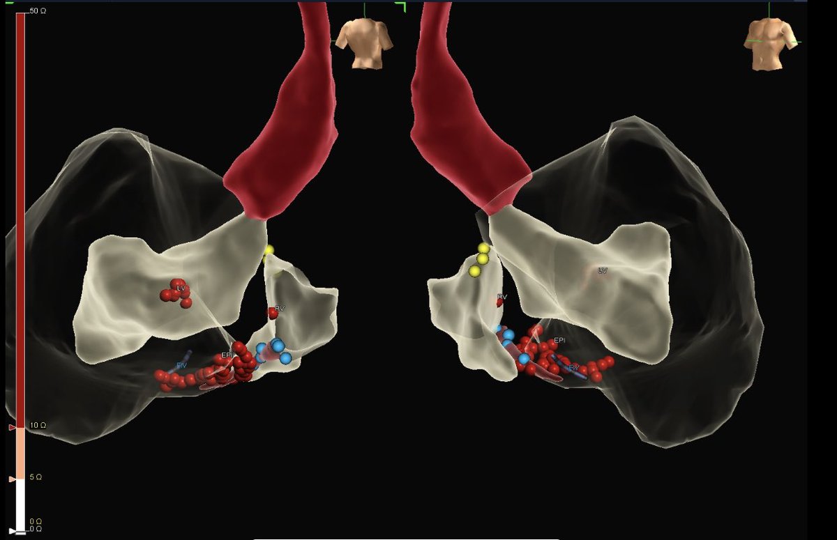 Jason Herzfeld tweet media