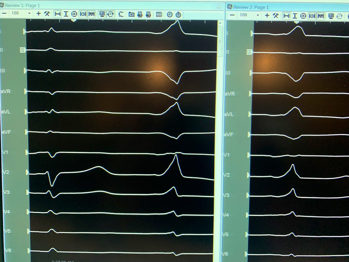 Jason Herzfeld tweet media