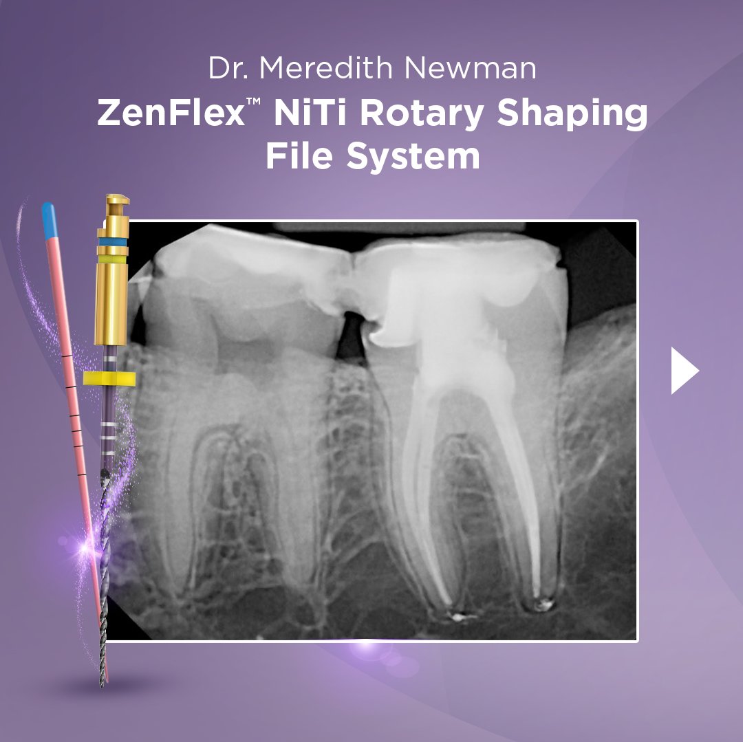 KerrDental's tweet photo. See what doctors are saying about the ZenFlex™ NiTi Shaping File System.
Request a Demo: : https://t.co/IwW8MWLsLf
#ZenFlex #ZenFlexNiTi #GuttaPercha #ShapingProcedures
The opinions and techniques shown are the recommendation of Dr. Meredith Newman, paid consultant of Kerr. https://t.co/pJdDDWq23v