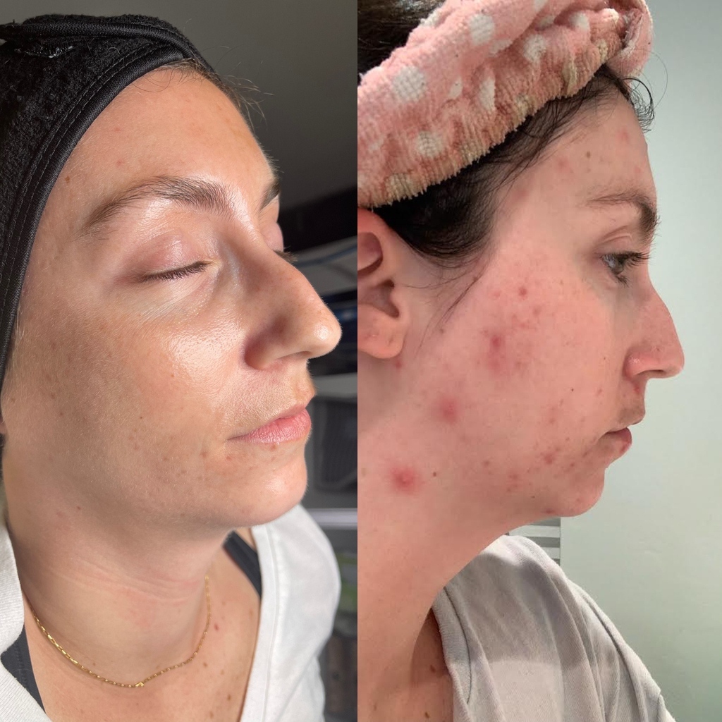 Nayak Plastic Surgery & Avani Derm Spa tweet media