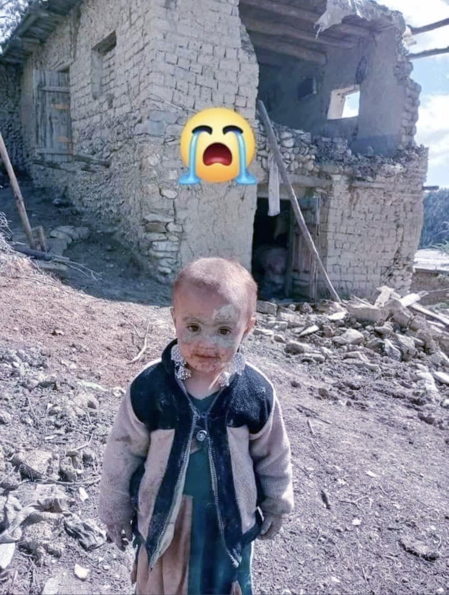 يو تصوير او زر خبرې !
دغه له دنيا بې خبره افغانه معشومه، 
په دې نه پوهيږي او نه يې فکر کار کوي چې څه پرې تير شوی او په تازه طبعي پيښه کې  يې څوک  له لاسه ورکړی.
  دردوونکی وضعيت .