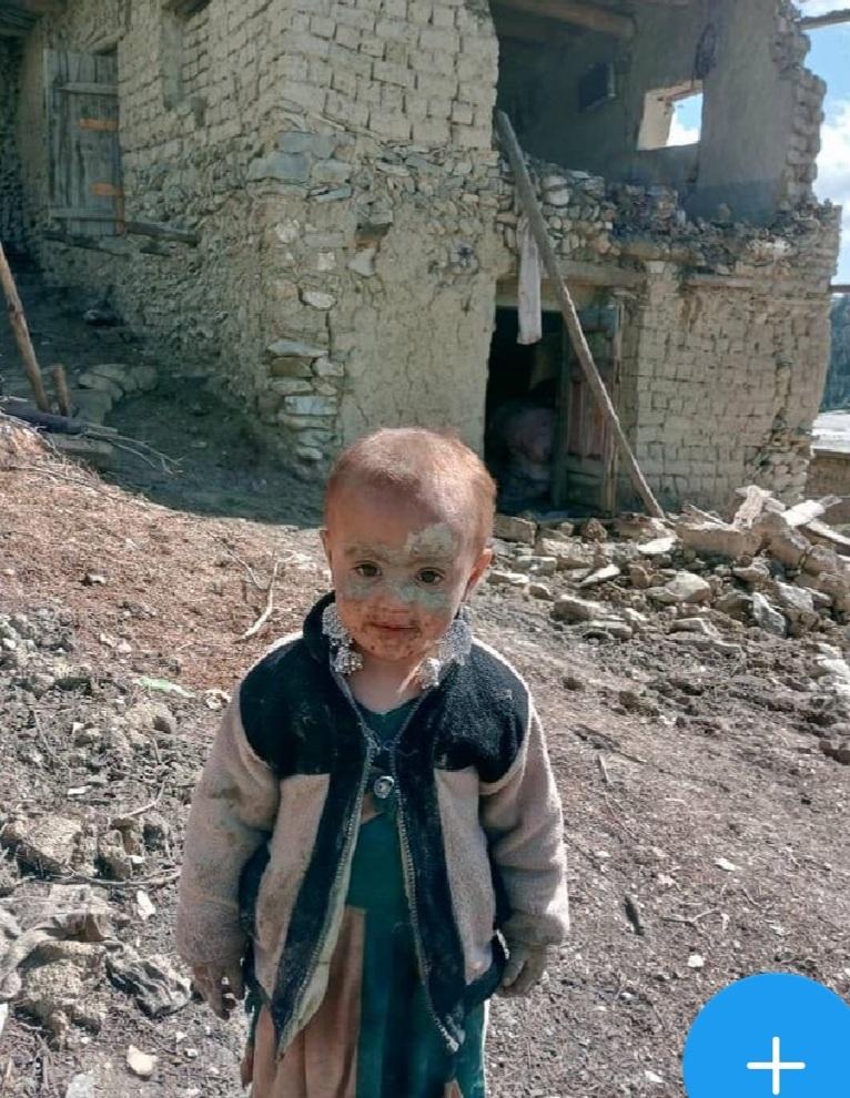 Emran_Feroz's tweet photo. In Afghanistan ereignete sich in der letzten Nacht eines der schlimmsten Erdbeben aller Zeiten. Dieses Kind hat seine gesamte Familie verloren. Ich habe für all dieses Leid keine Worte mehr, und für die Ignoranz und das Desinteresse ebenso. https://t.co/cJIvV0fCi1