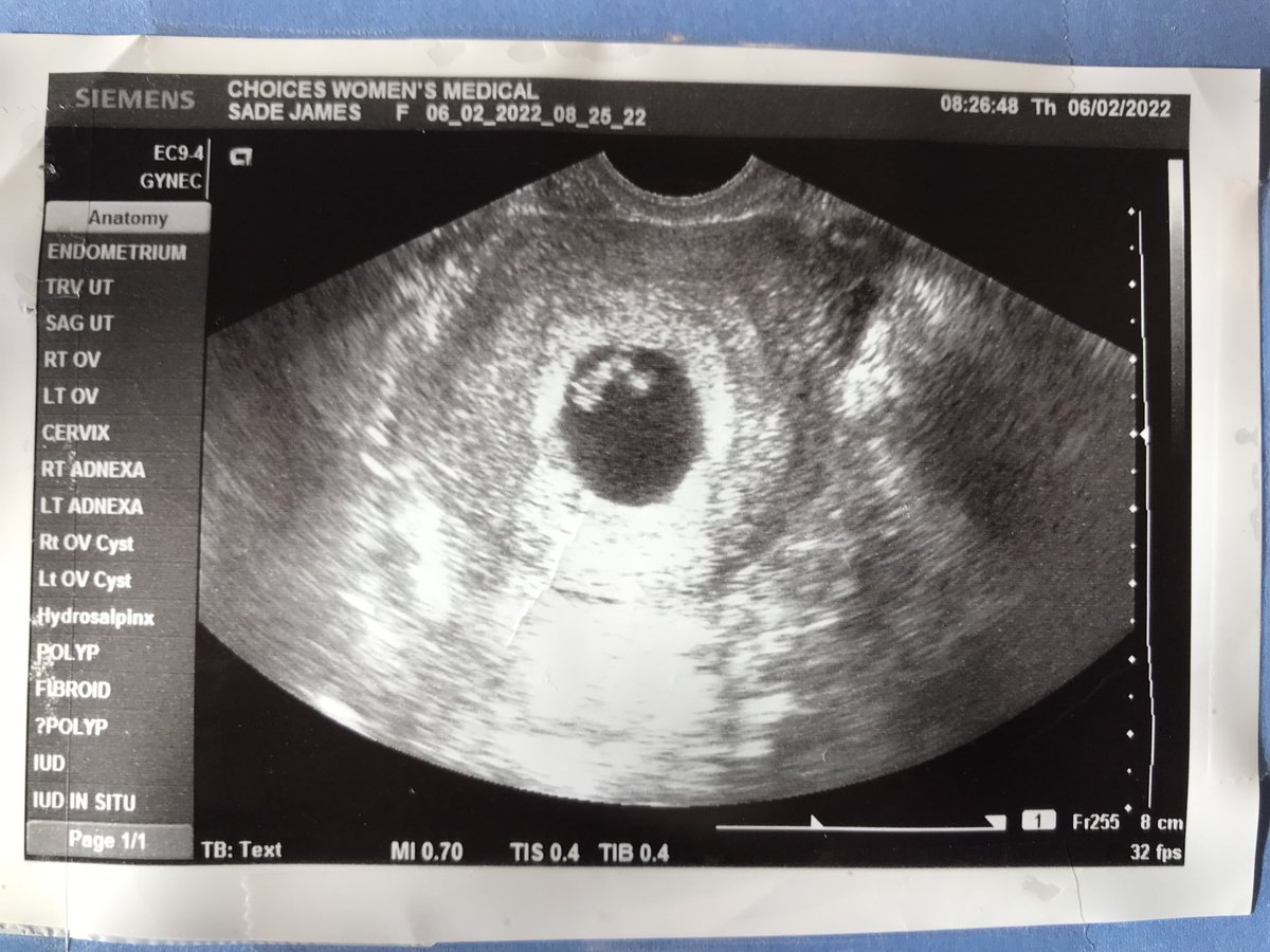 TmicBX's tweet photo. Welcome to the “Fraternity of Fatherhood” son..LvU https://t.co/IGm0GFZGno