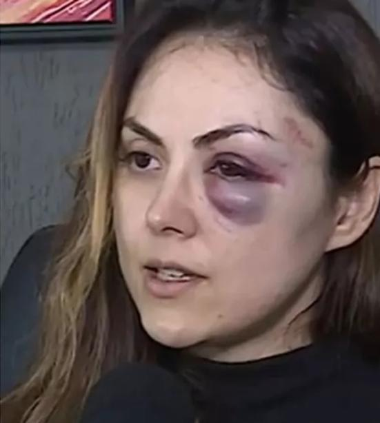 📢 Polícia pediu a prisão preventiva do procurador Demétrius Oliveira de Macedo, que agrediu brutalmente e de forma covarde a procuradora-geral em Registro

Esse caso jamais poderá ficar impune, esperamos que a justiça seja feita

Ele NÃO pode continuar sorrindo ✊🏽