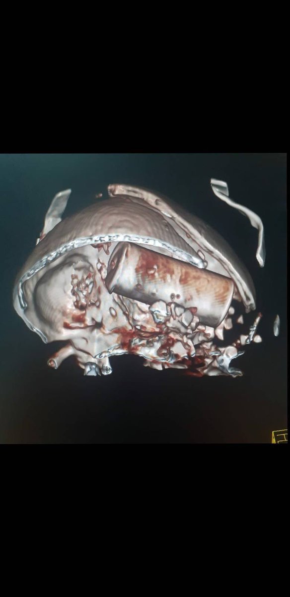 Kawsachun News on Twitter "Ecuador's confeniae1 publishes the CT scan