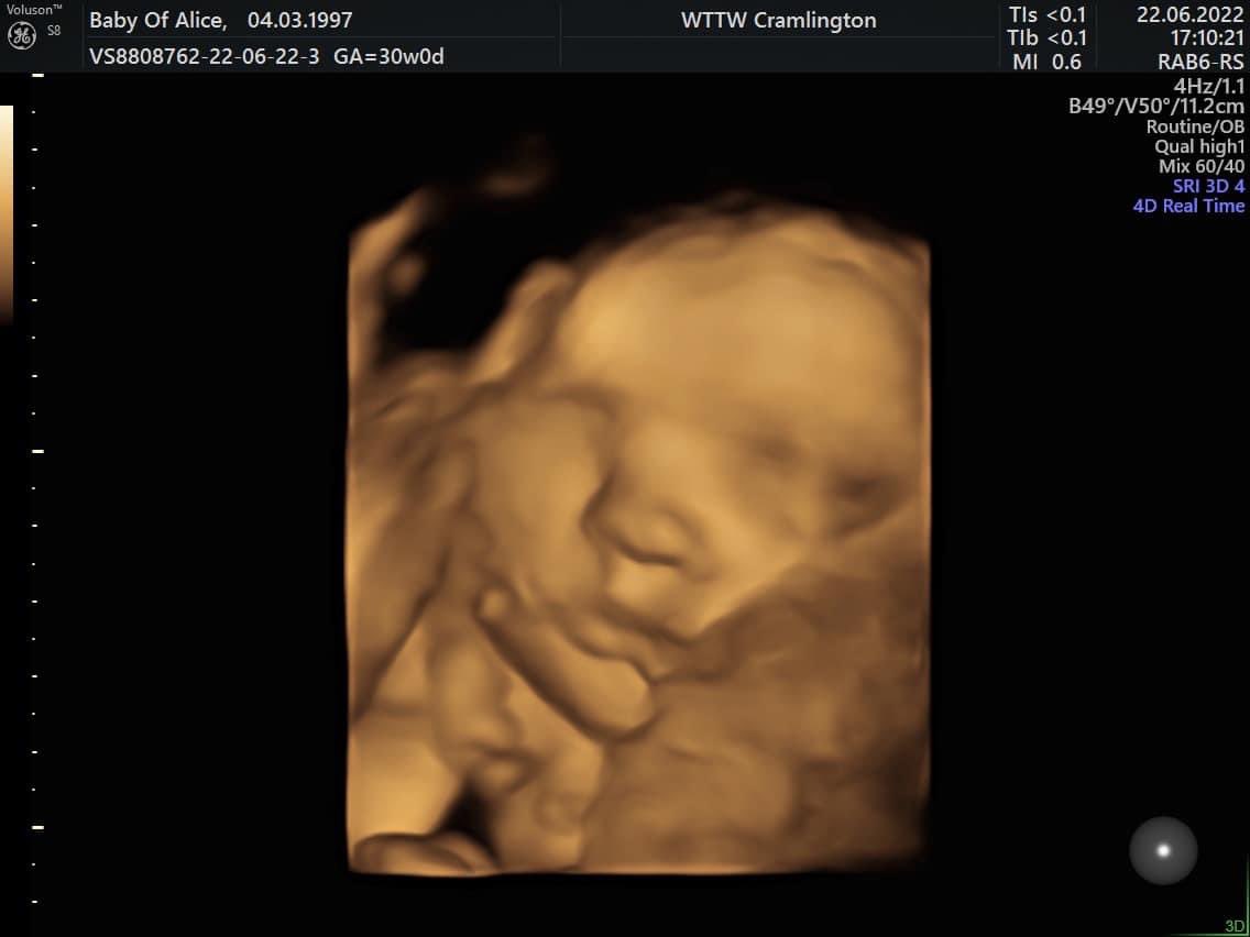 McFaddener_1988's tweet photo. My niece can’t wait to meet you #10weekstogo 💗 https://t.co/yUSx1D0ZNZ