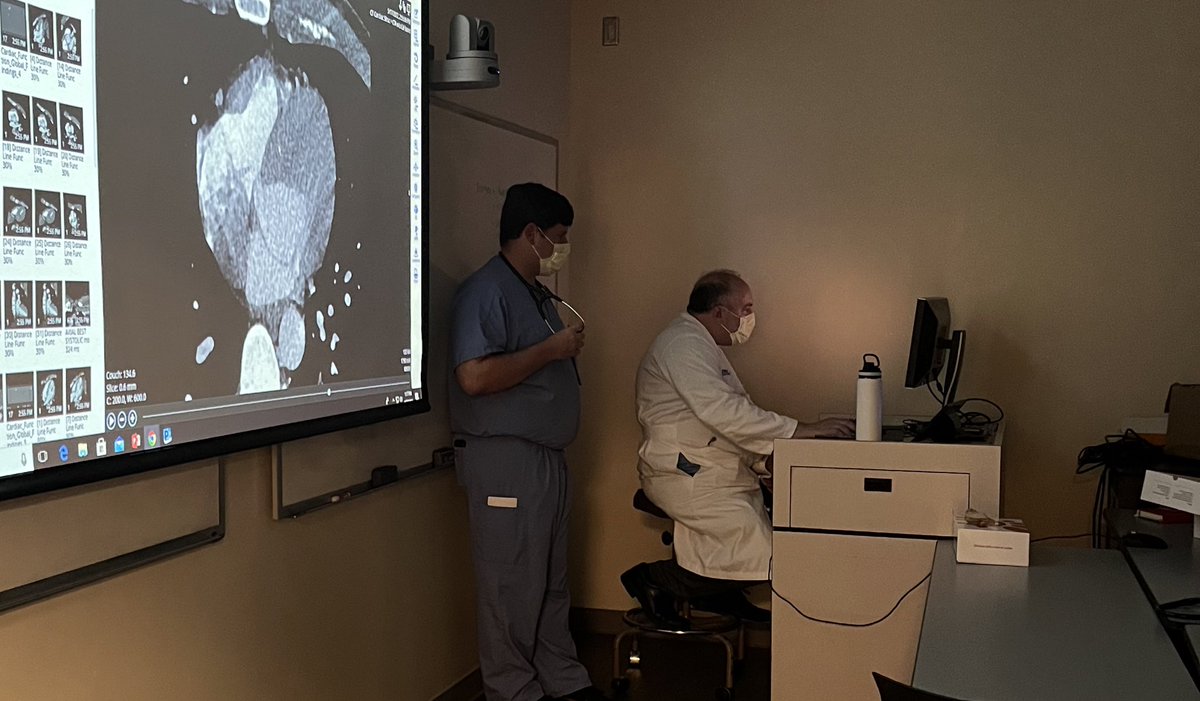 A 26 y/o with bicuspid AV presents with subacute dysuria, fatigue, and fevers, found to have strep sanguinis bacteremia and an aortic root abscess. Thanks PGY1 Michael Britt for presenting, and @david_krakow for working through this case with us!