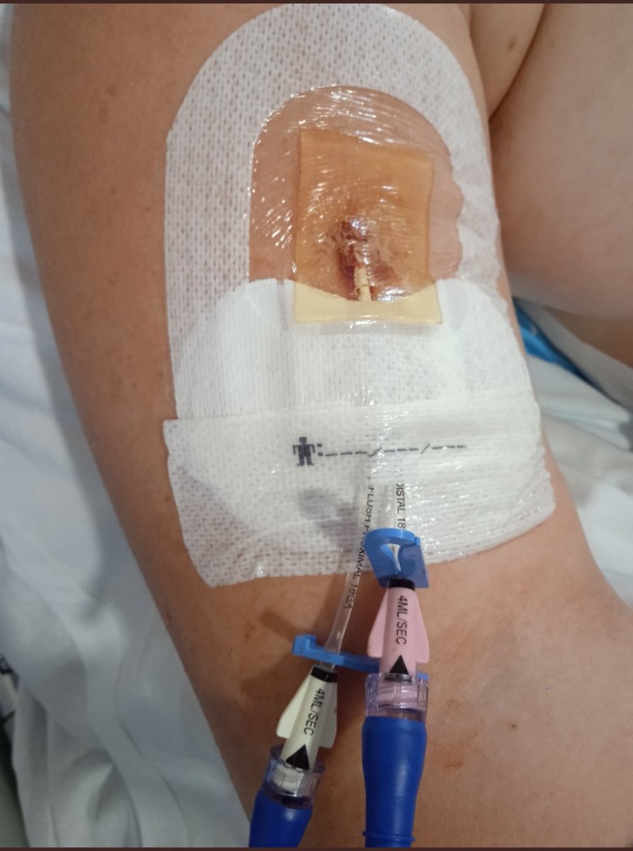 JuanMGG1's tweet photo. Encuentra las 7 diferencias 🤦‍♂️🤦‍♂️😉 @BPSOaccesovenos @turruchi @xiscferr @bpsobalears 
Por la seguridad de nuestros pacientes a través del conocimiento basado en la evidencia y la excelencia en los cuidados 💪🏽💪🏽💪🏽 https://t.co/K9rzy1WoL4