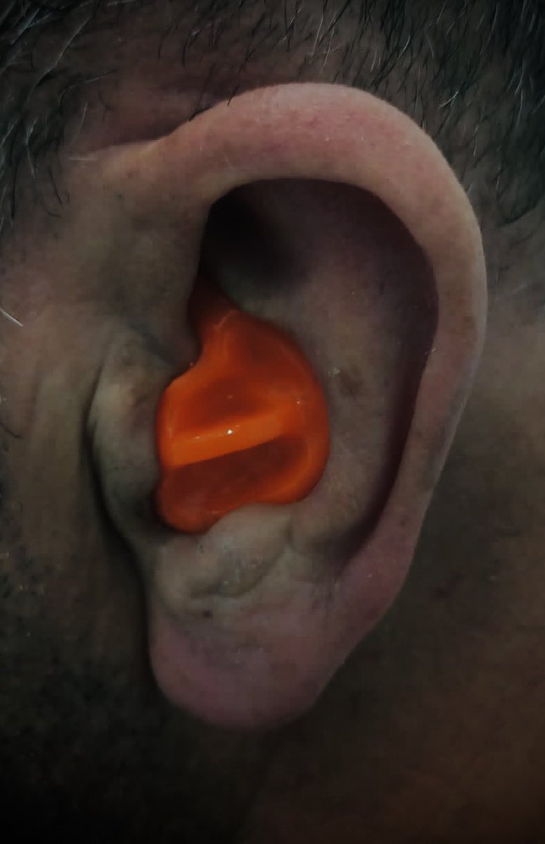 odyoplasti's tweet photo. Earplugs to protect from water. 

Photo from lab 🧪 

#orange #plugs #earplugs #turkey #ear #laboratory #earmold #otoplastik #3D #handmade #handcrafted #kulaktıkacı https://t.co/I8lKGBQ5KT