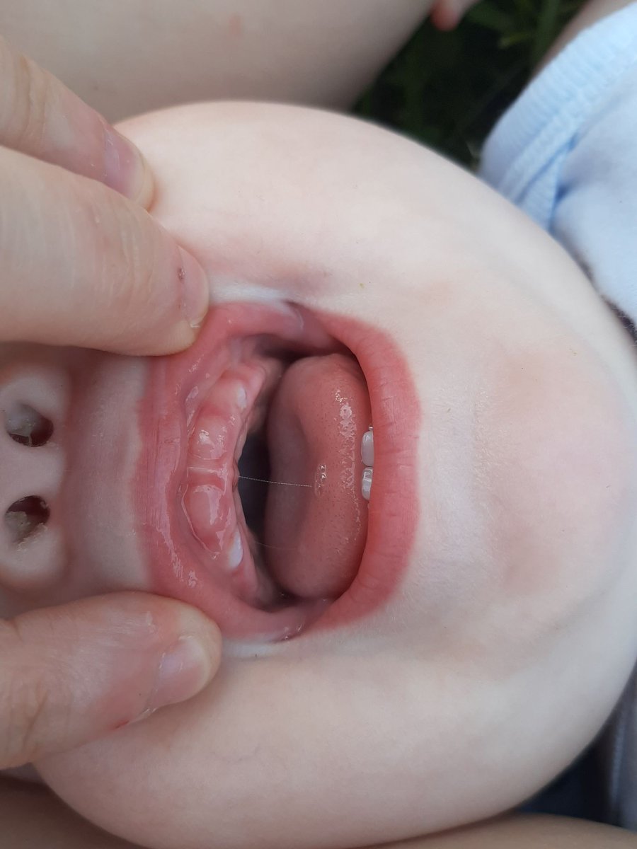 Le_Pofin's tweet photo. Encore des dents #teamNo5 https://t.co/FIn7Ew8kpk
