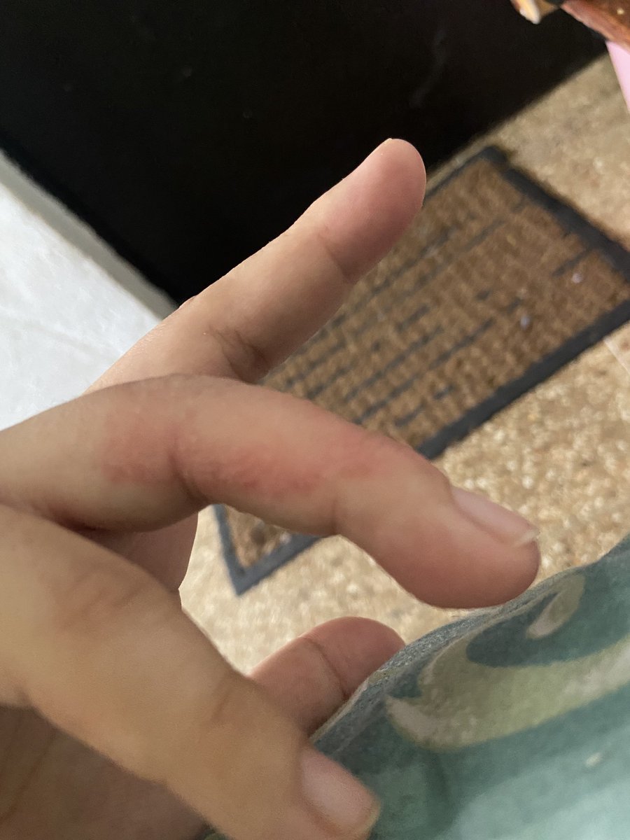 Cuando yo no me preocupó mi cuerpo busca como demostrarlo 🥺