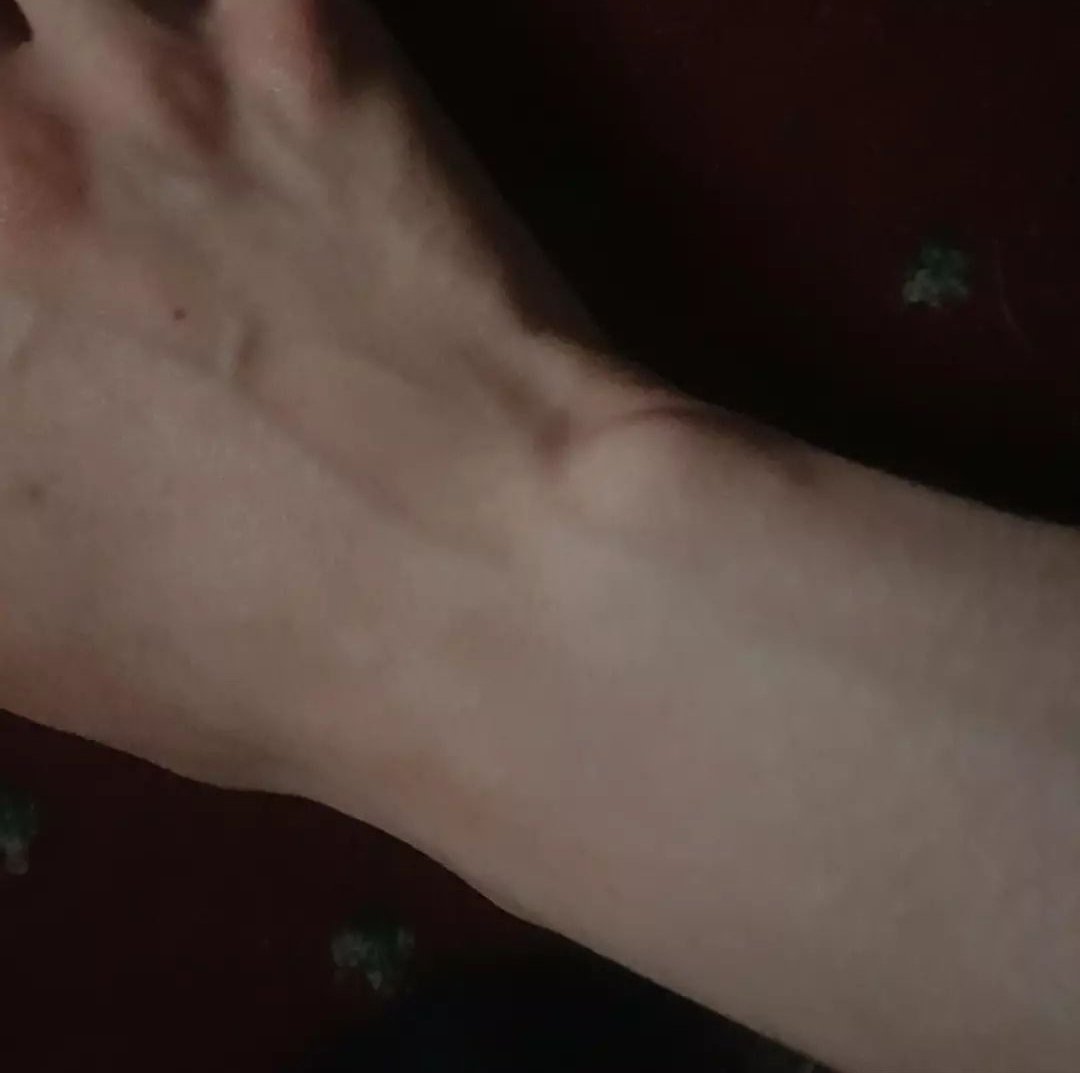 Guess who arm is this?