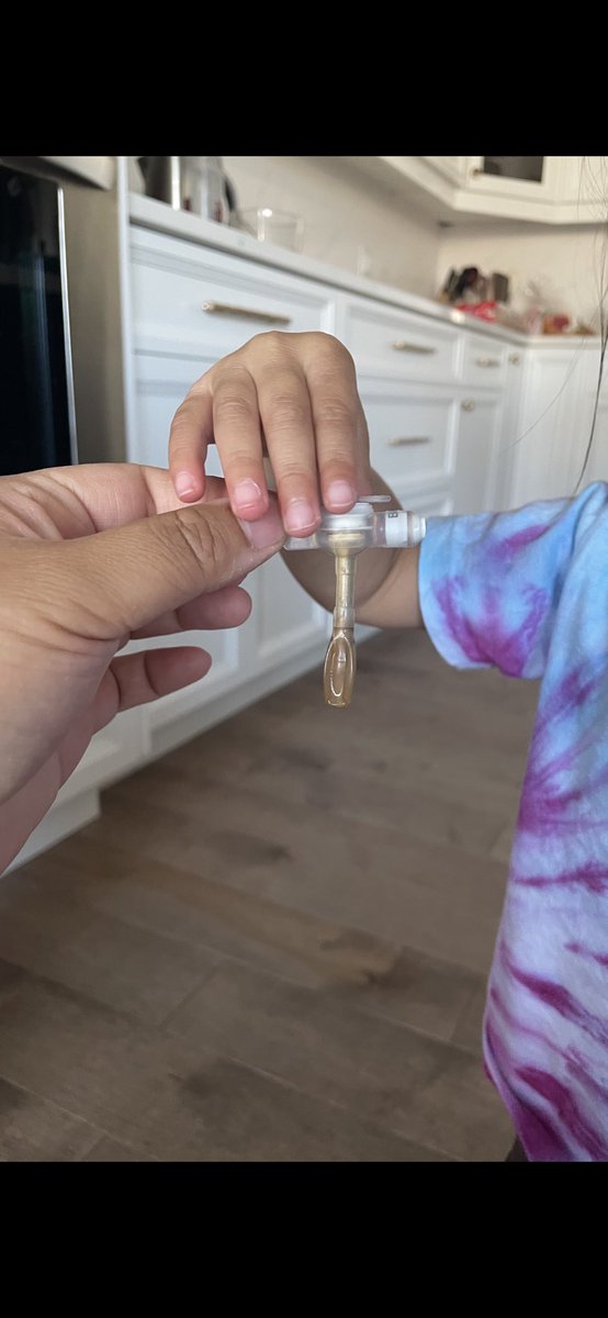 A year ago we switched from peg tube to a mic key button g tube, and today we were cleared to take it out for good!

I am so grateful for this little life saving device, and to be celebrating a third birthday this weekend!