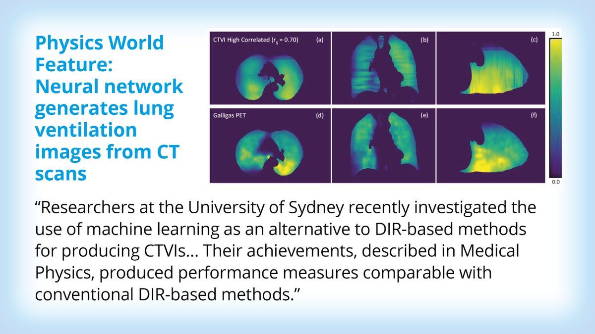 Image X Institute (@imagexinstitute) on Twitter photo Superstar masters student James Grover uses #ai to generate high quality lung ventilation images from regular 4DCTs. His exciting work has been featured in <a href="/PWMedPhys/">Physics World Medical Physics</a>🎉tinyurl.com/2zn7v9qc #ECR #medicalimaging #medphys Superstar masters student James Grover uses #ai to generate high quality lung ventilation images from regular 4DCTs. His exciting work has been featured in <a href="/PWMedPhys/">Physics World Medical Physics</a>🎉tinyurl.com/2zn7v9qc #ECR #medicalimaging #medphys
