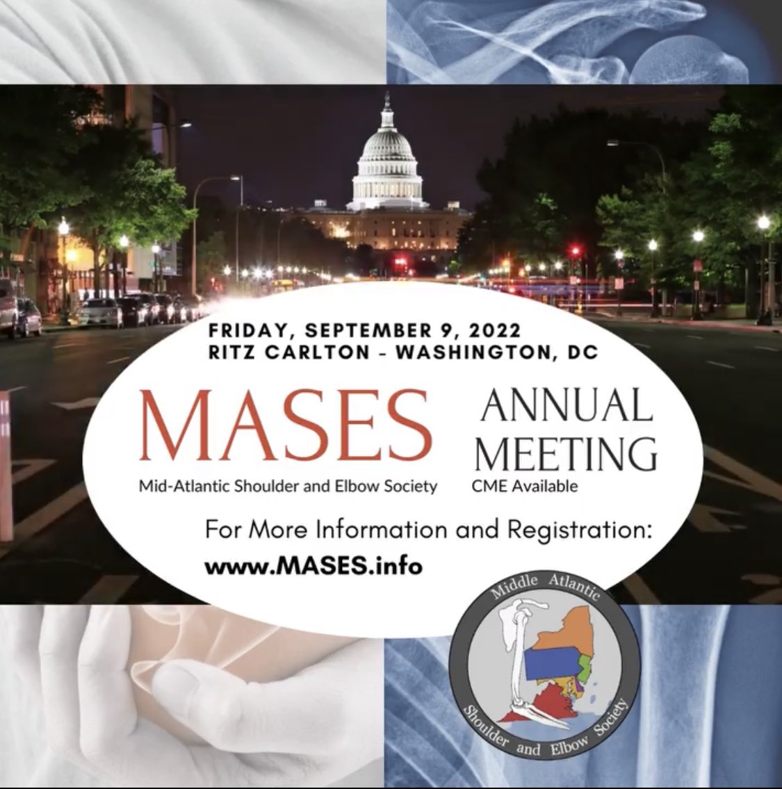 MikeKnudsenMD's tweet photo. Hey #orthotwitter ! Looking forward to seeing you all in #DC for the Mid-Atlantic Shoulder and Elbow Society #MASES meeting on Friday, September 9th, 2022 !
Register at https://t.co/fJJr3JGAAJ https://t.co/mlpq7kCb9v